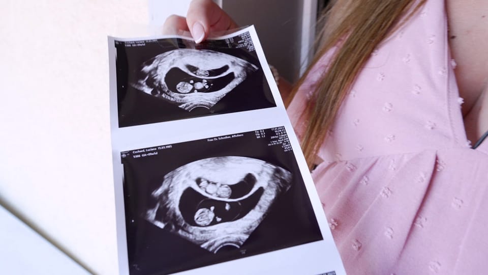 Abtreibung bei Trisomie 21 – Frauen brechen ein Tabu