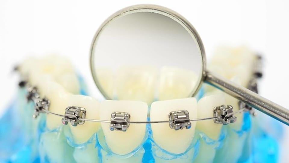 Zahnspange – Schnellere Korrektur dank Infrarotlicht