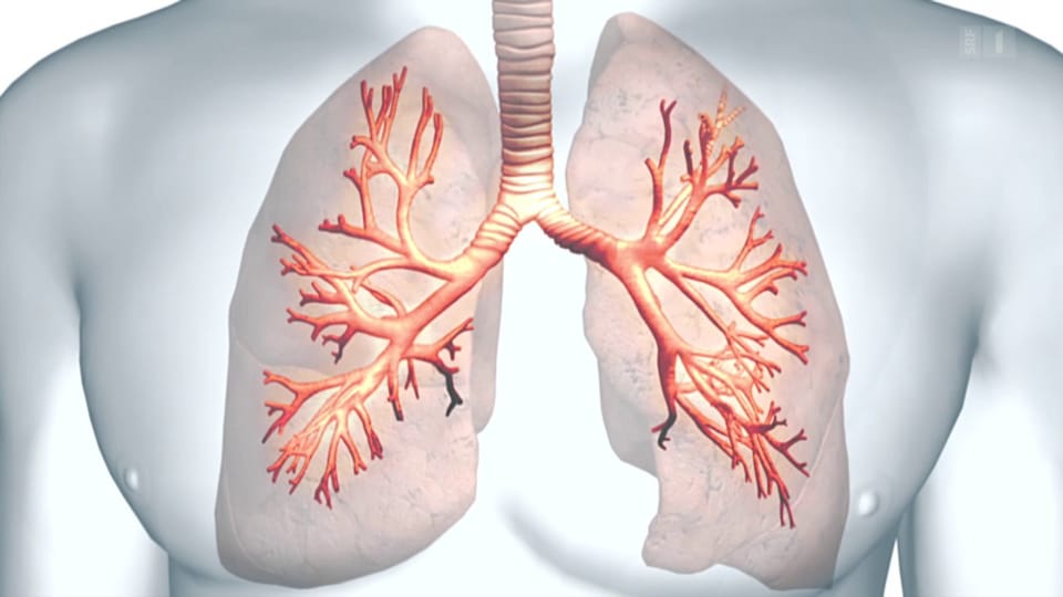 Asthma - Umstrittene Methode soll helfen