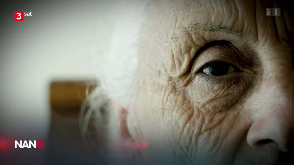 Diagnose Alzheimer-Demenz