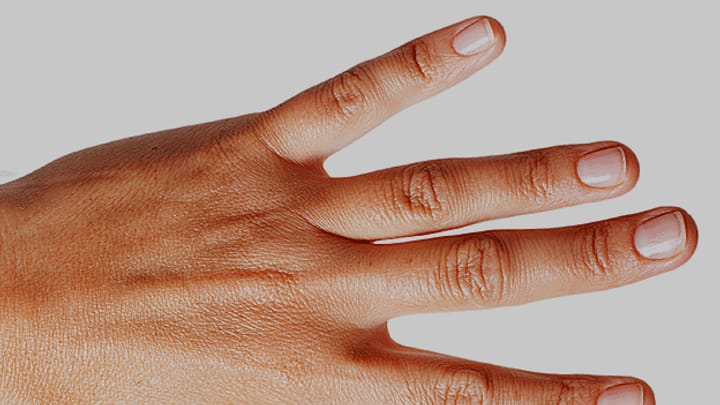 Was Fingernägel über unsere Gesundheit aussagen
