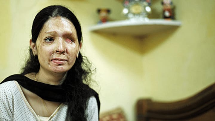 Reshma Qureshi – Opfer eines Säureangriffs geht in die Offensive