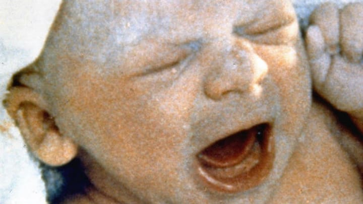 Heute vor 39 Jahren: Geburt des ersten Retortenbabys