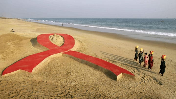 Etappensieg bei der Behandlung von Aids?