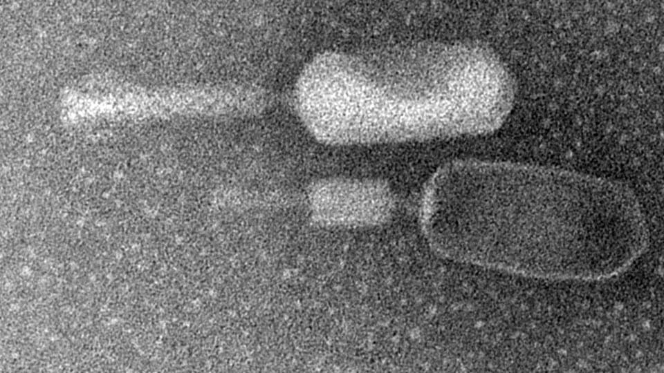 Aus dem Archiv: Phagen als Ausweg aus der Antibiotika-Krise?