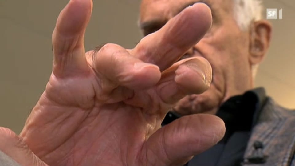 Neue Behandlungsmethode löst unbewegliche Finger