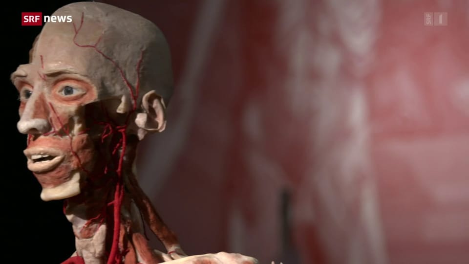 «Körperwelten» – wie aus Leichen Ausstellungsobjekte werden