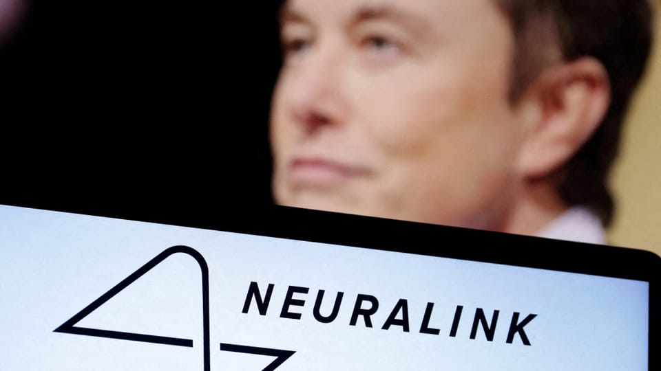 Gehirnimplantate von Neuralink: Was steckt hinter Musks Start-up?