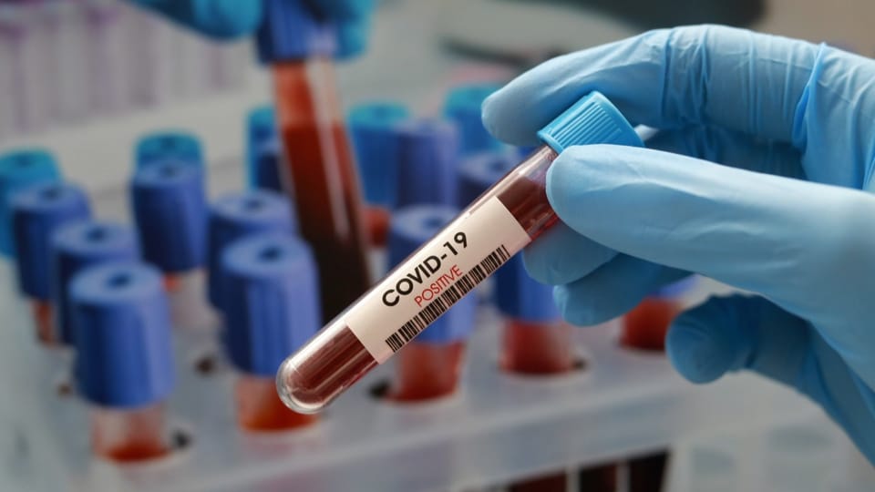 Sind PCR-Tests unpräzise?