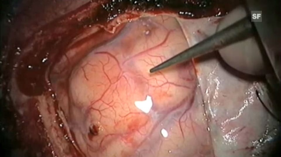1990-2010: «Puls» schaut hin, wo's weh tut 1990-2010: «Puls» schaut hin, wo's weh tut