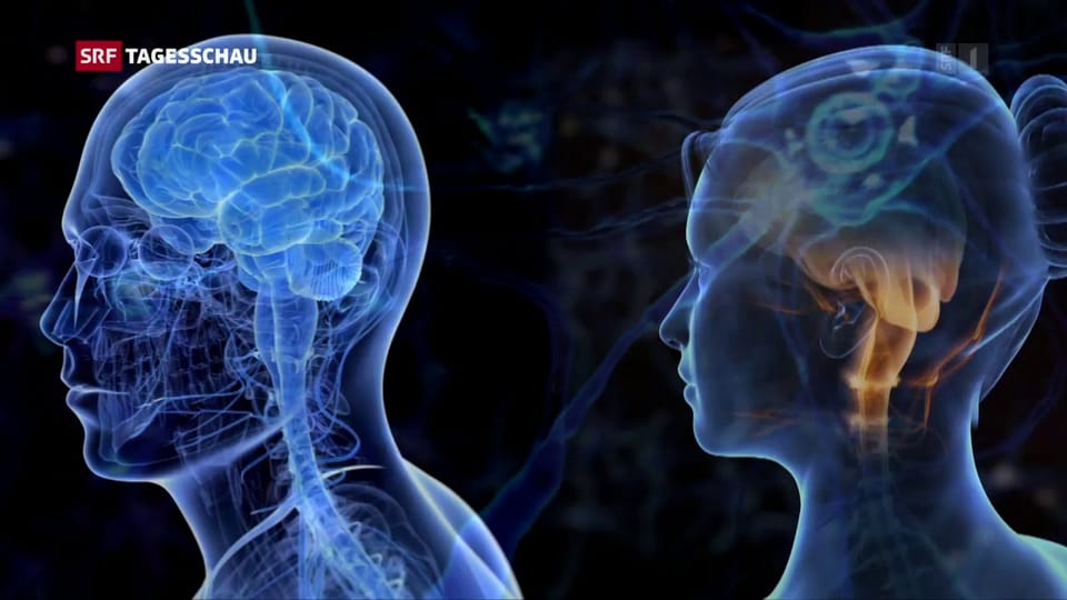 Gendermedizin: «Womens Brain Project» will eigenes Institut