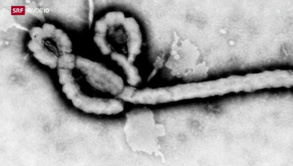 Beispielloser Ebola-Ausbruch in Westafrika
