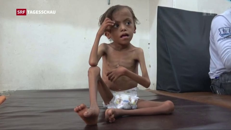 Im Jemen droht erneut eine Hungersnot