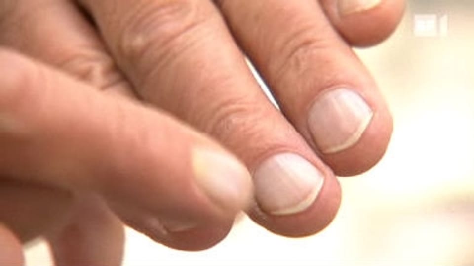Gesunde Nägel - Was Fingernägel über die Gesundheit verraten