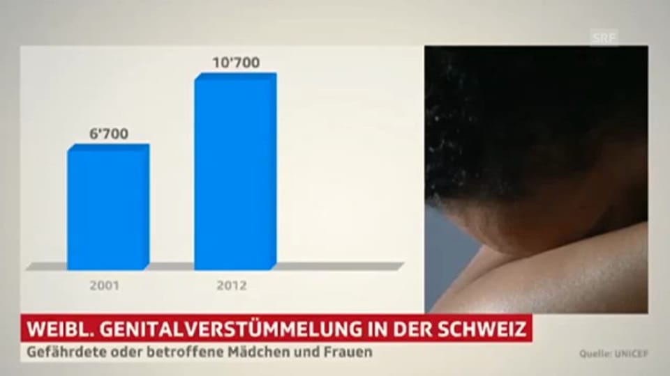 Weibliche Genitalverstümmelung in der Schweiz nimmt zu. 