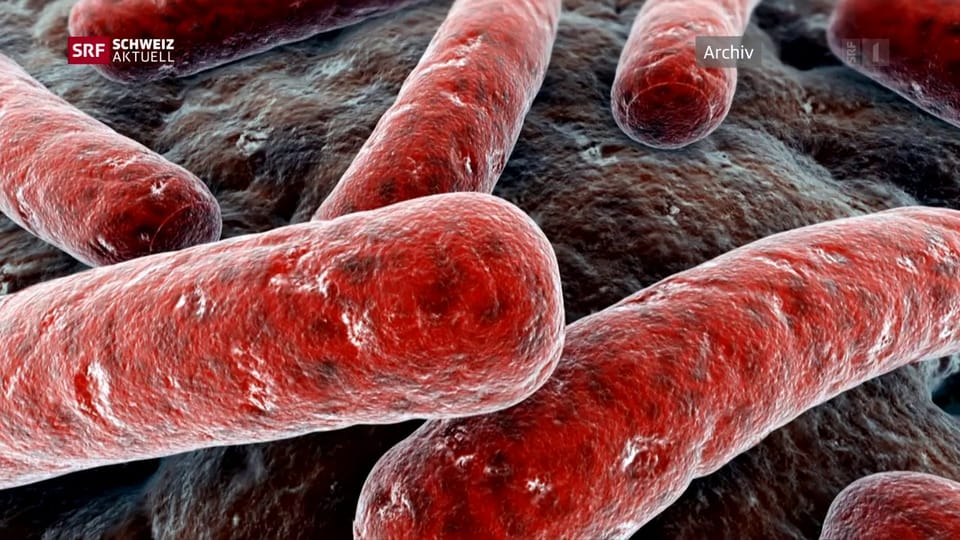 Zwei Tuberkulosefälle an Aargauer Schulen