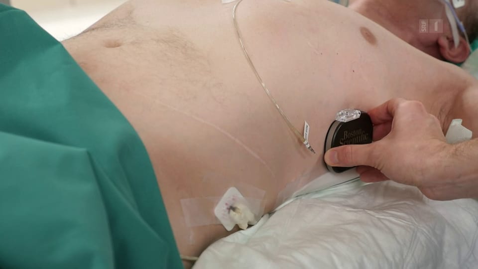 Defibrillatoren - Warum der Batteriewechsel so heikel ist
