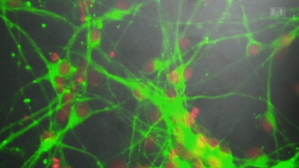 Neue Nervenzellen gegen Parkinson