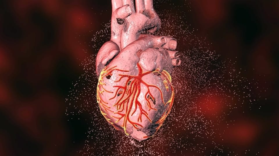Verengte Herzgefässe – Neue Chance für Problemfälle