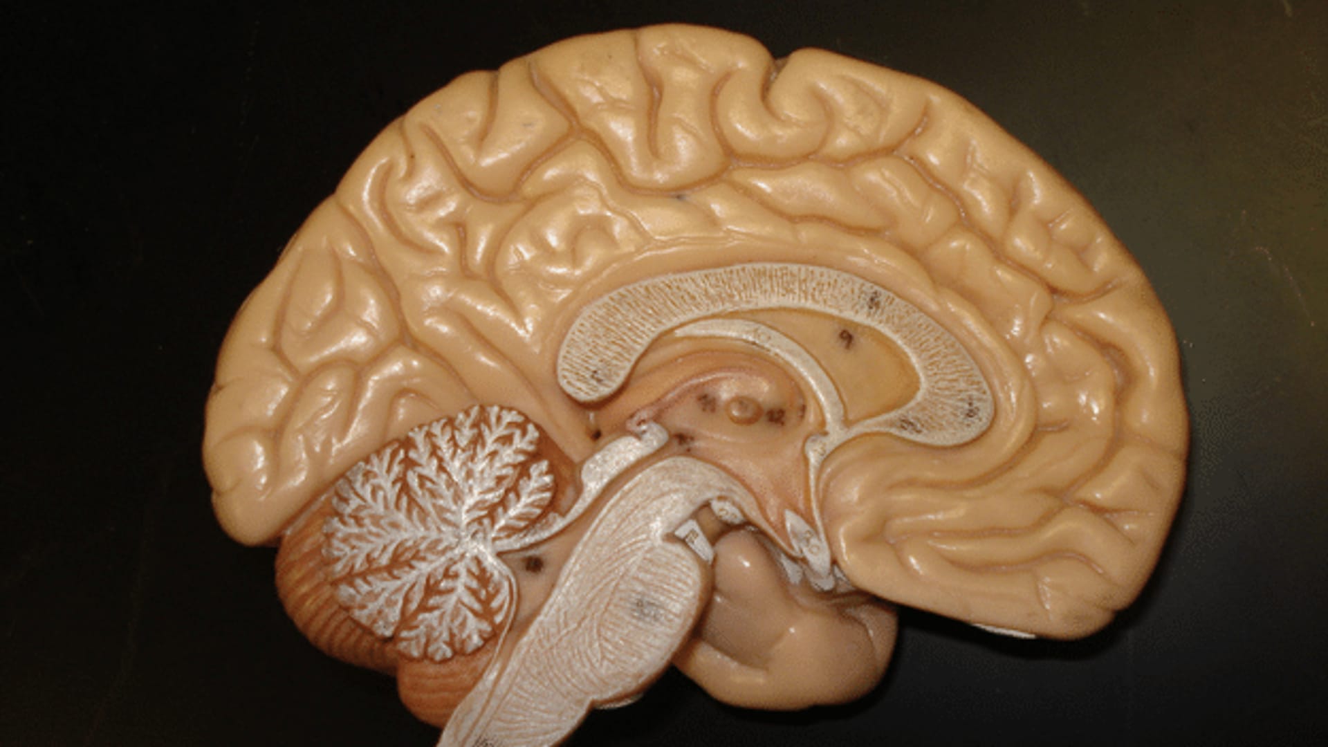 Präfrontaler Cortex – Der Regisseur im Gehirn - Wissen - SRF