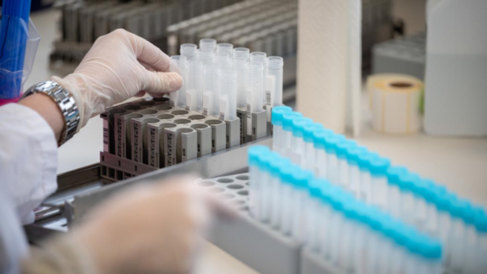 PCR-Test: Für Laboranalysen im Ausland werden Kosten nicht übernommen