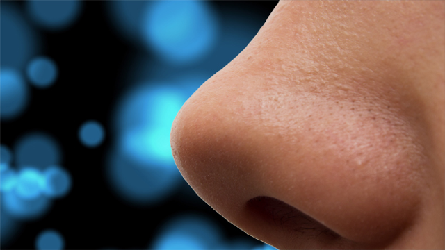 Jemandem Die Wurmer Aus Der Nase Ziehen Radio Play Srf